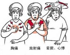 冠心病有哪些癥狀？