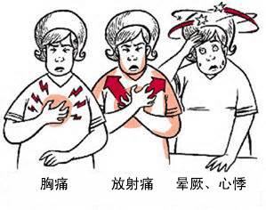 冠心病有哪些癥狀？(圖1)